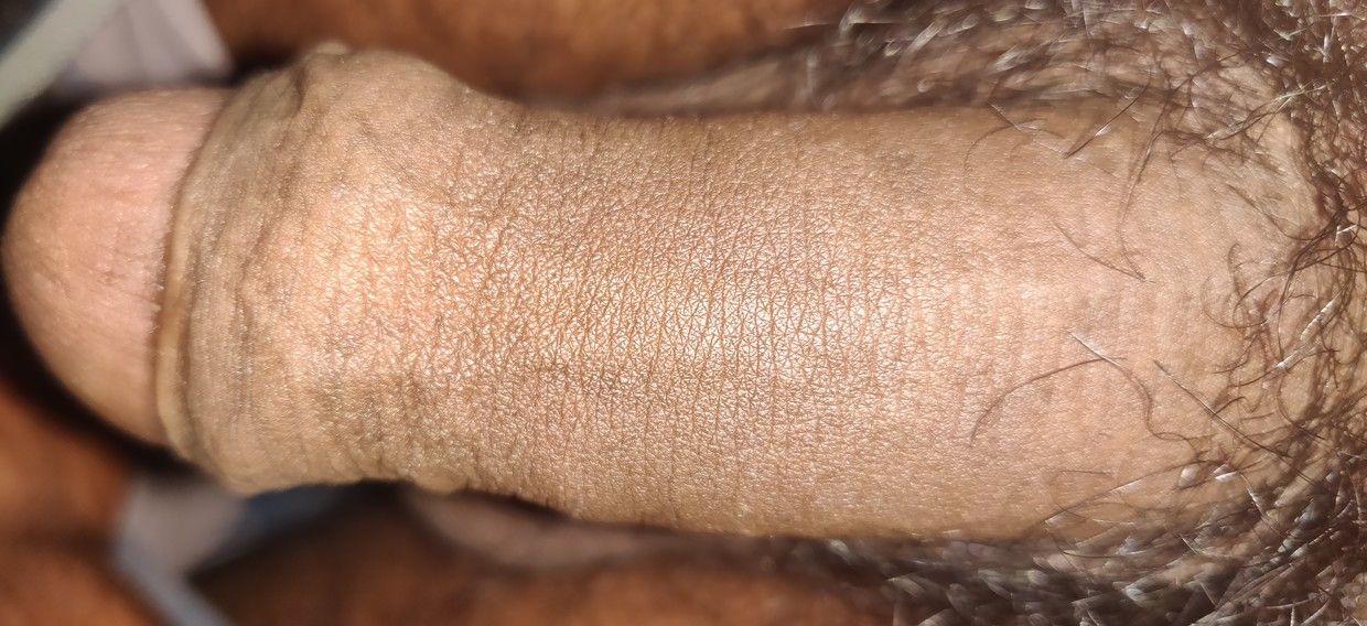 Foto Hairy Skinny Foto Hairy Skinny